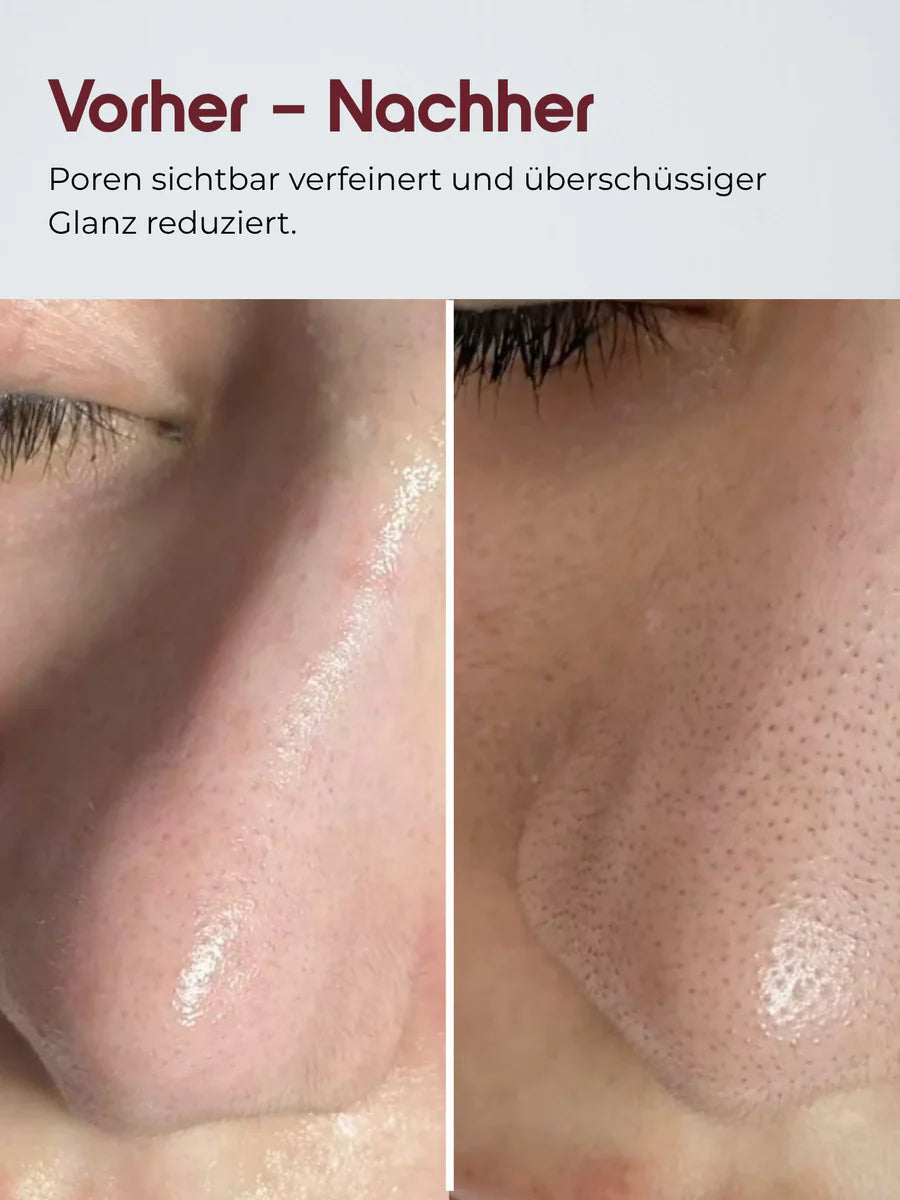 DYON Lumière Rice Serum
