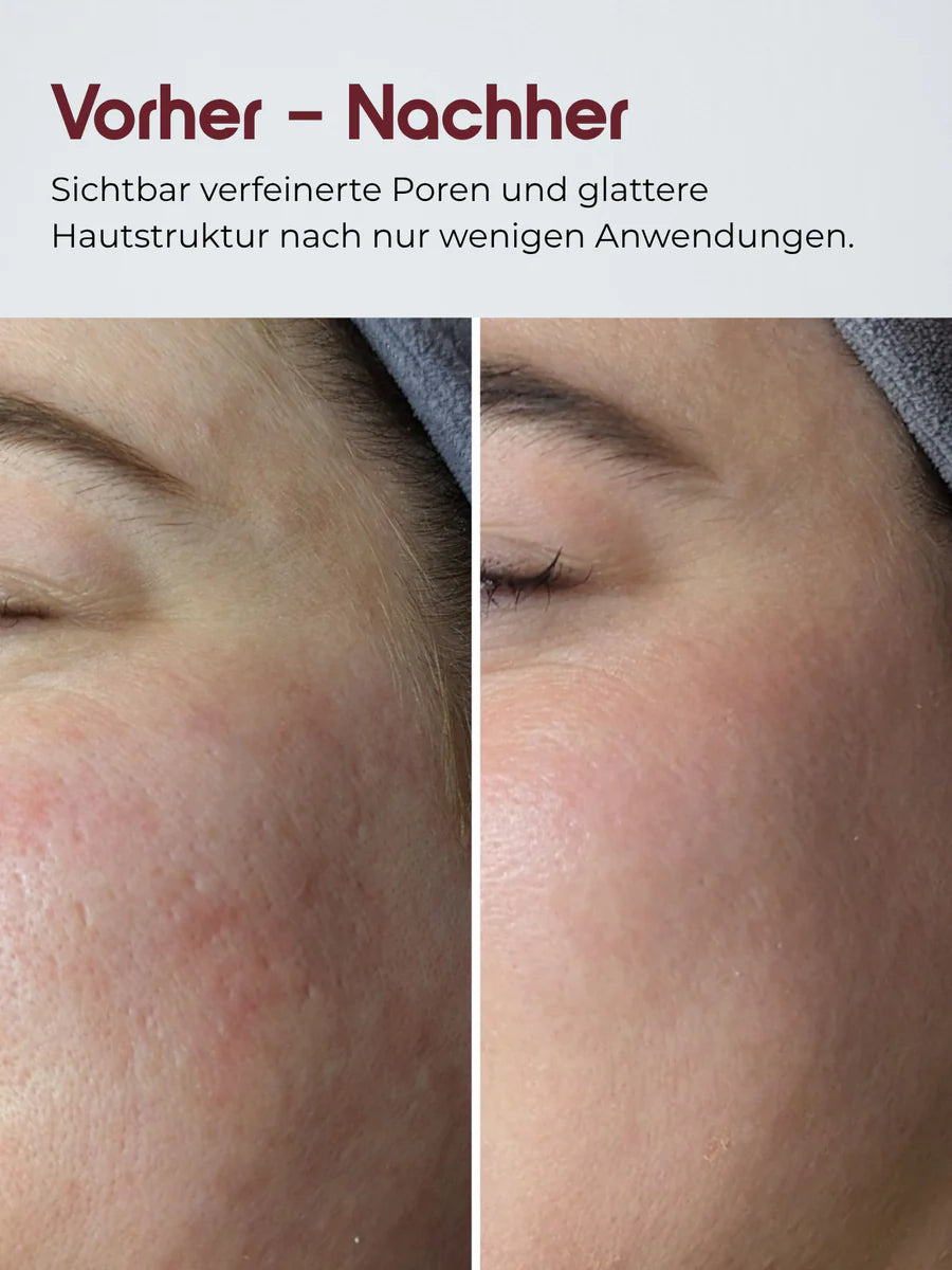 DYON Lumière Rice Serum