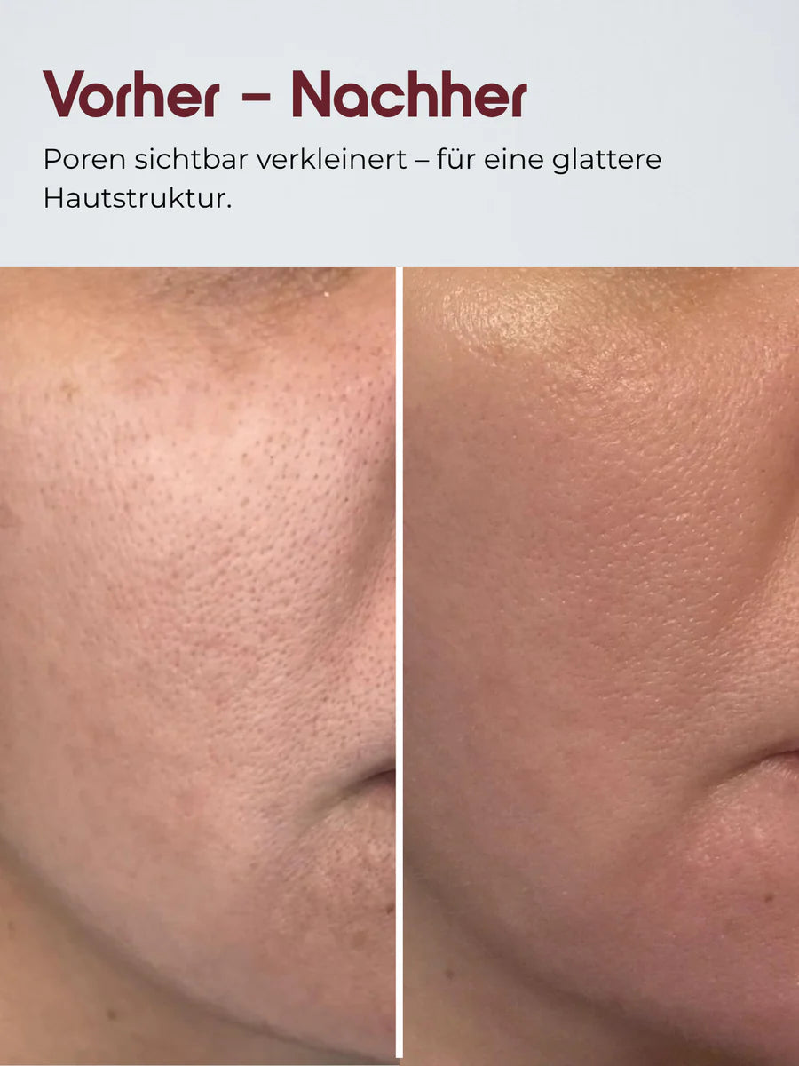 DYON Lumière Rice Serum
